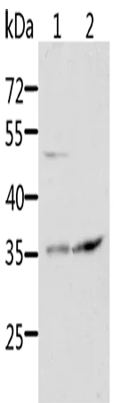 SOCS1 Polyclonal Antibody - image 1