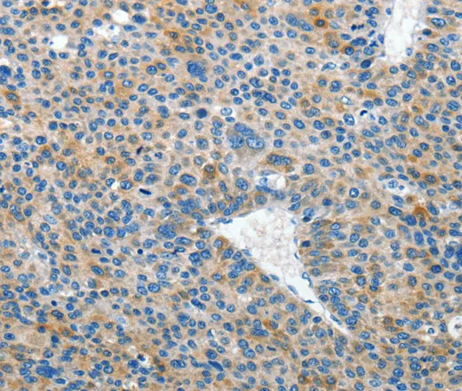 EPHB3 Polyclonal Antibody - image 1