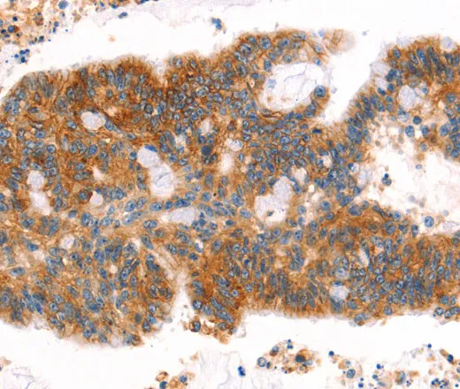 AFDN Polyclonal Antibody - image 1
