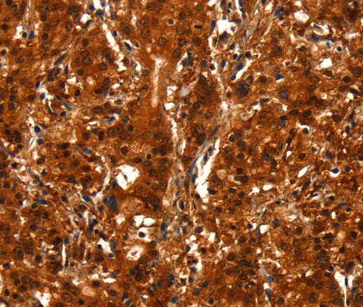 BCAS3 Polyclonal Antibody - image 1