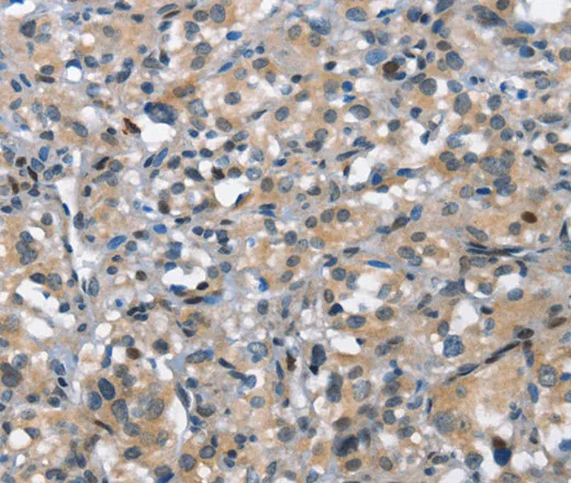 DDR2 Polyclonal Antibody - image 1