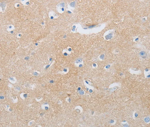 CD10 Polyclonal Antibody - image 1