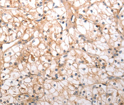 HCRTR1 Polyclonal Antibody - image 1