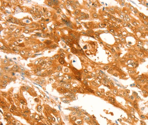TRPM7 Polyclonal Antibody - image 1