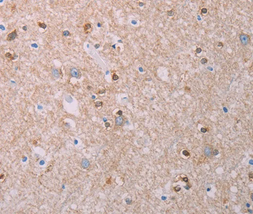 AKT2 Polyclonal Antibody - image 1