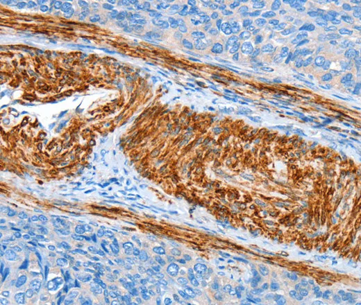 AARS Polyclonal Antibody - image 1