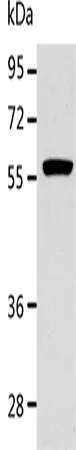 ALDH1A2 Polyclonal Antibody - image 1
