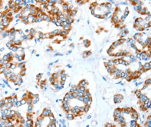 ALDH5A1 Polyclonal Antibody - image 1