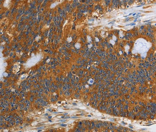 PI 3 Kinase Class 3 Polyclonal Antibody - image 1