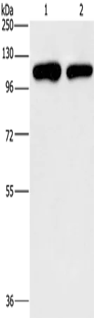 PIP5K1C Polyclonal Antibody - image 1