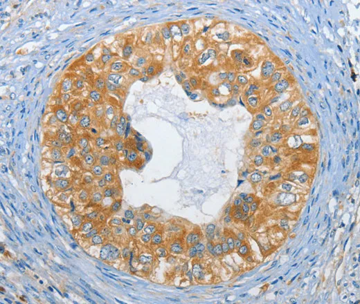 DGK zeta Polyclonal Antibody - image 1