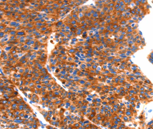 SEPT4 Polyclonal Antibody - image 1