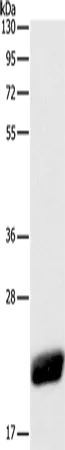 CAV1 Polyclonal Antibody - image 1