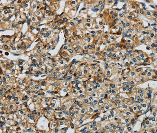 PERK Polyclonal Antibody - image 1
