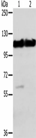 ACTN2 Polyclonal Antibody - image 1