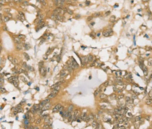 SIGLEC15 Polyclonal Antibody - image 1