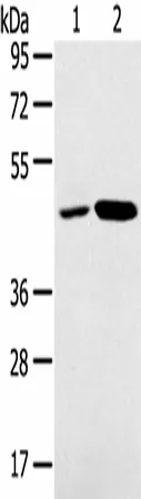 SNX5 Polyclonal Antibody - image 1