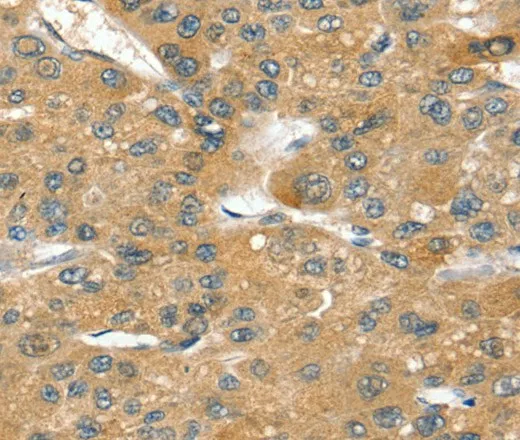 SORT1 Polyclonal Antibody - image 1