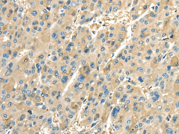 COX2 Polyclonal Antibody - image 1