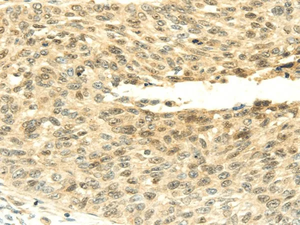 SHPRH Polyclonal Antibody - image 1