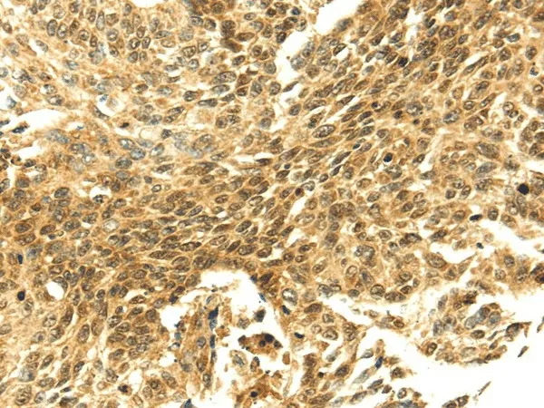 SHPRH Polyclonal Antibody - image 1