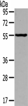 THRA Polyclonal Antibody - image 1
