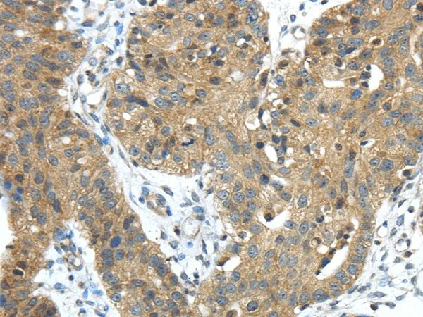 TMPRSS11E Polyclonal Antibody - image 1