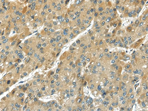 TMPRSS11D Polyclonal Antibody - image 1