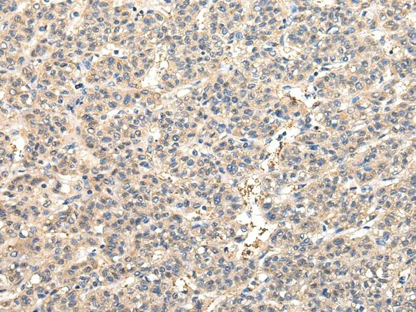 VPS45 Polyclonal Antibody - image 1