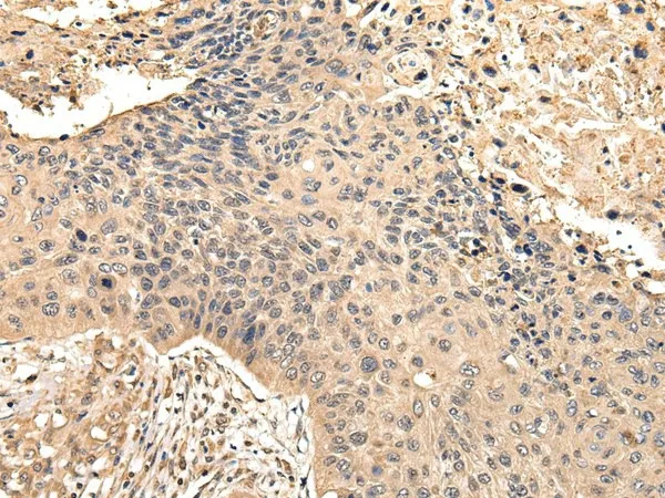 VPS35 Polyclonal Antibody - image 1