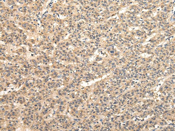 VPS33B Polyclonal Antibody - image 1