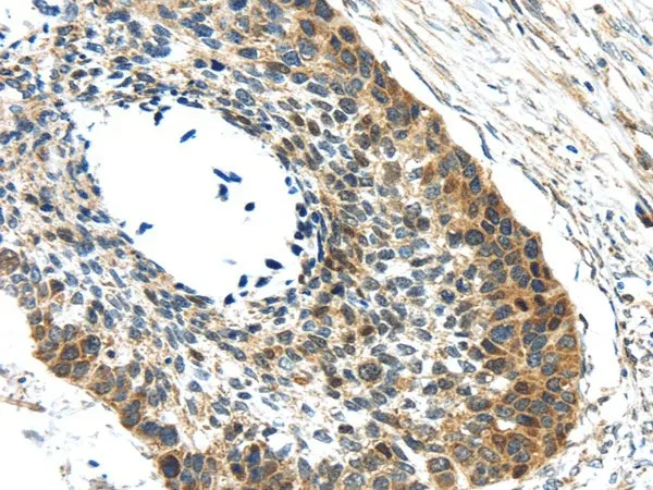GRIN2A Polyclonal Antibody - image 1