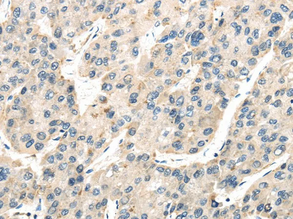 TXNIP Polyclonal Antibody - image 1
