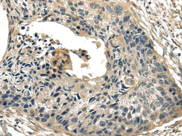 TXNIP Polyclonal Antibody - image 1