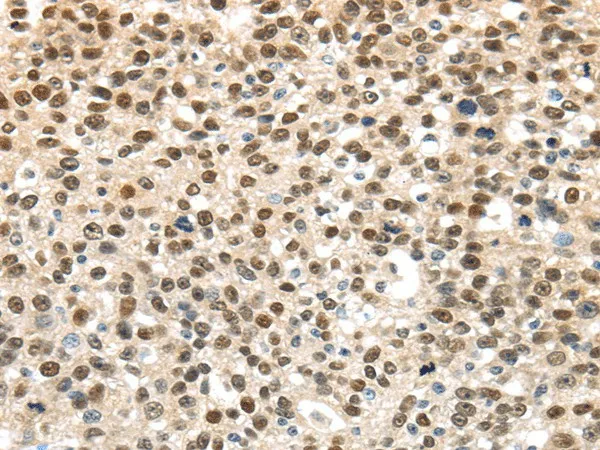 UBA1 Polyclonal Antibody - image 1