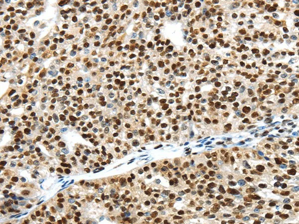 UBA1 Polyclonal Antibody - image 1