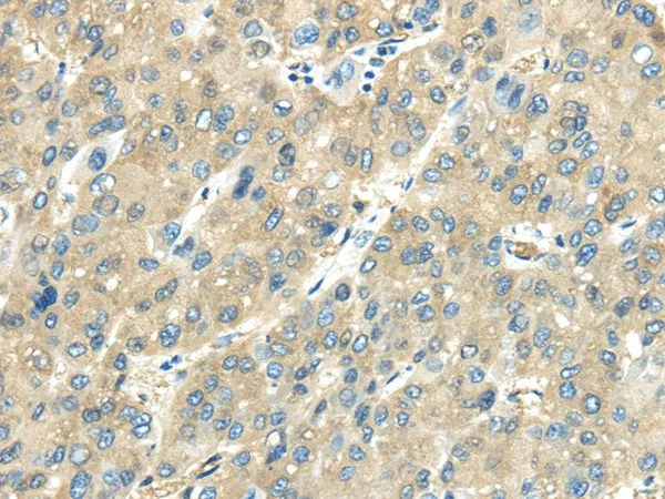 VPS4A Polyclonal Antibody - image 1
