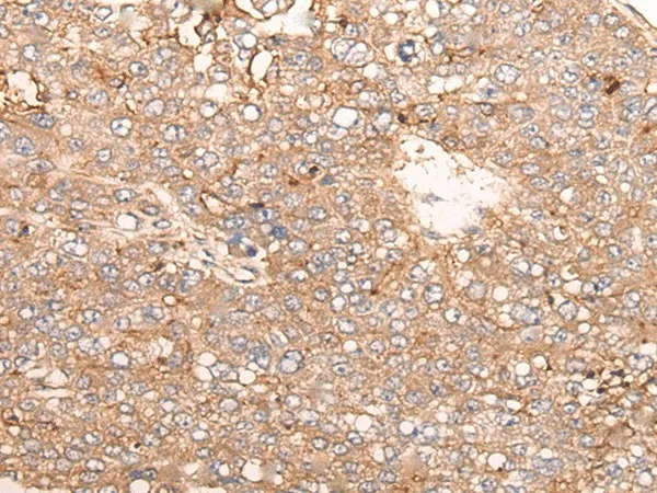 SIGLECL1 Polyclonal Antibody - image 1