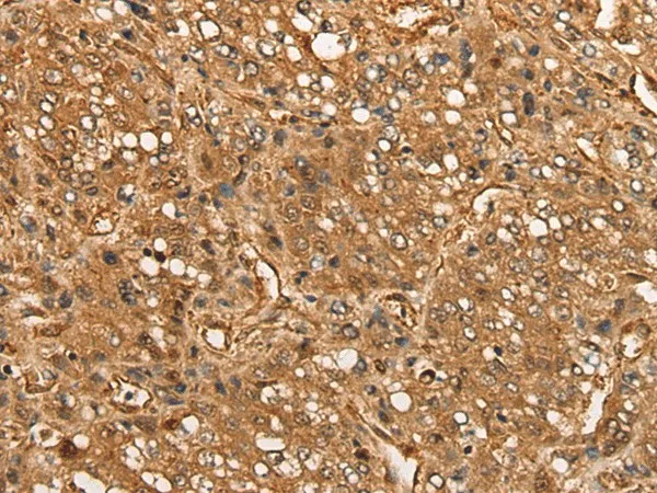 CALML6 Polyclonal Antibody - image 1