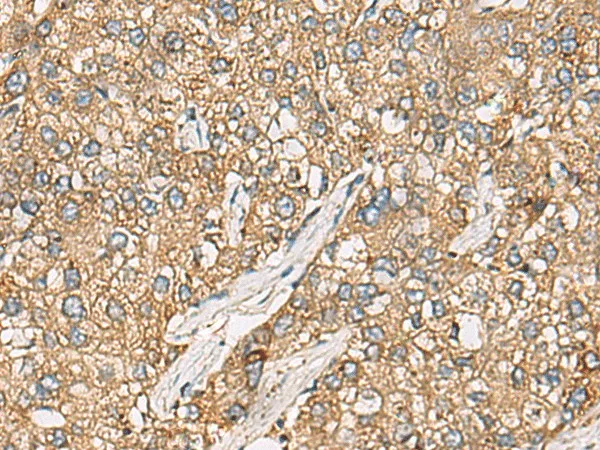 CHKA Polyclonal Antibody - image 1