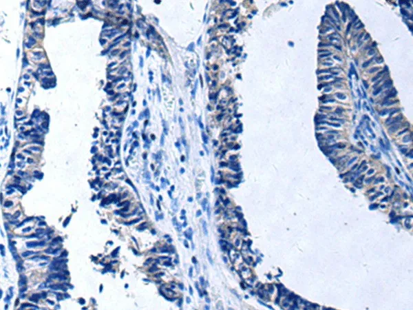 PROC Polyclonal Antibody - image 1