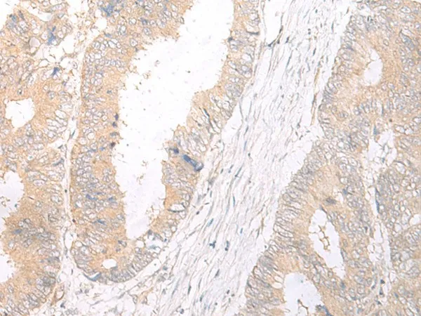 HLA-C Polyclonal Antibody - image 1