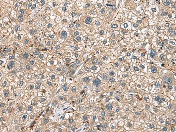 HLA-DRA Polyclonal Antibody - image 1