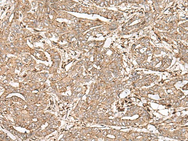 FAAP24 Polyclonal Antibody - image 1