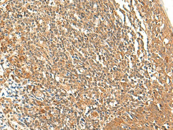 TSHB Polyclonal Antibody - image 1