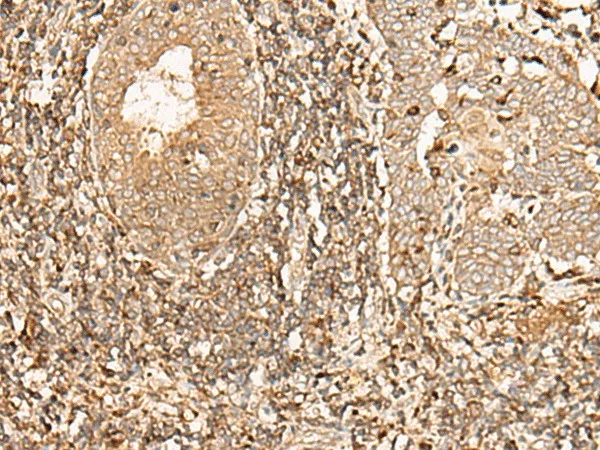 GALR2 Polyclonal Antibody - image 1