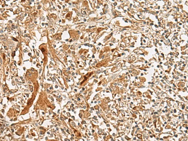 GCC2 Polyclonal Antibody - image 1