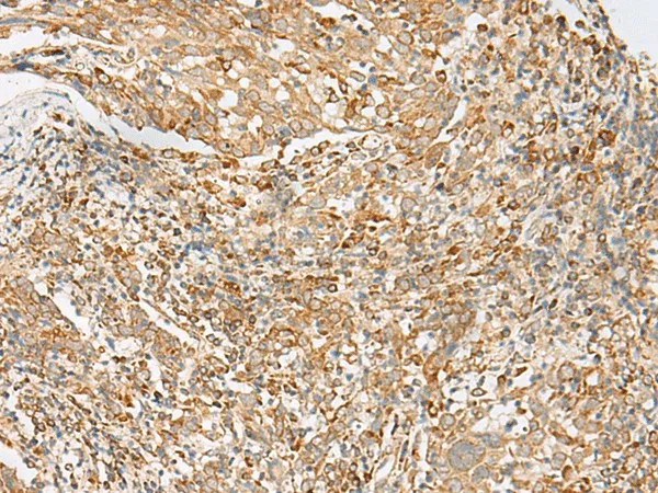 MBOAT4 Polyclonal Antibody - image 1