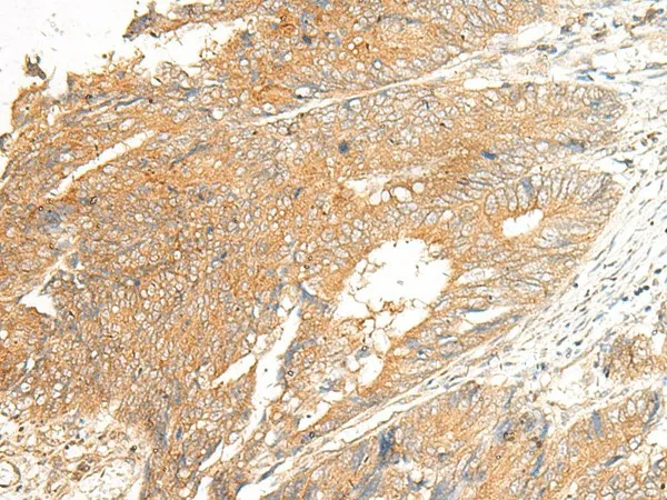 C5AR2 Polyclonal Antibody - image 1