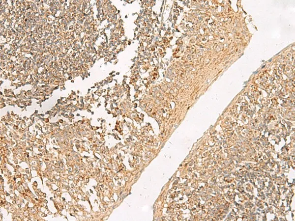 GRIK5 Polyclonal Antibody - image 1